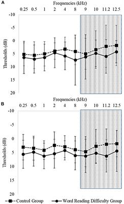 Comorbidity of Auditory Processing, Attention, and Memory in Children With Word Reading Difficulties